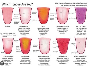 Ib Tshooj Lus Txog Gua Sha Color Chart